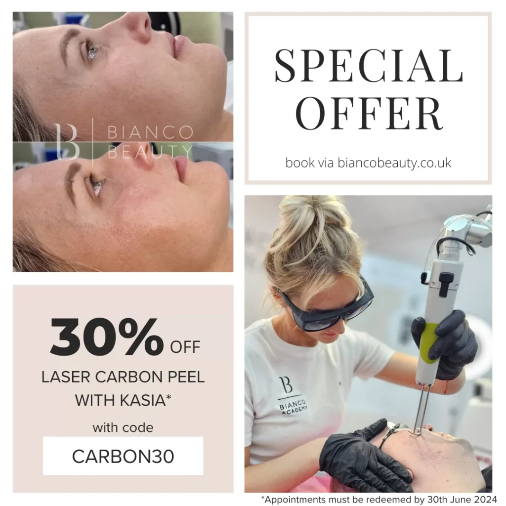 Laser Carbon Peel