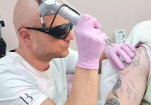 Tattoo Removal vs Tattoo Cover-Up