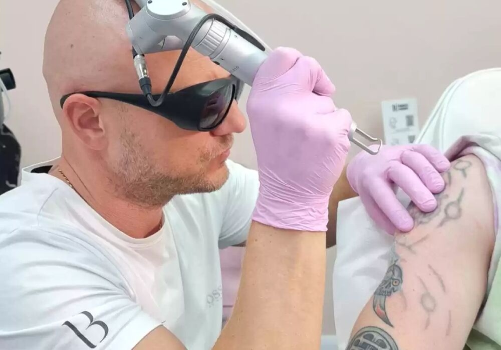 Tattoo Removal vs Tattoo Cover-Up