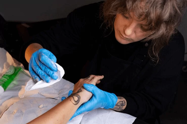 Tattoo Removal Franchise for Aesthetic Practitioner