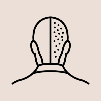 scalp-removal