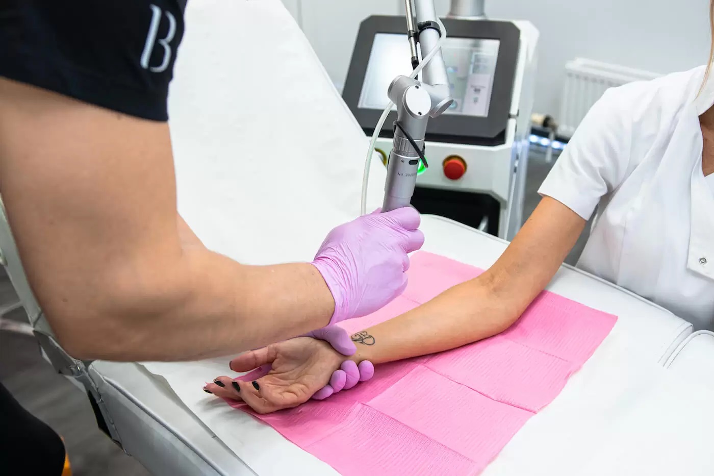 laser tattoo removal process
