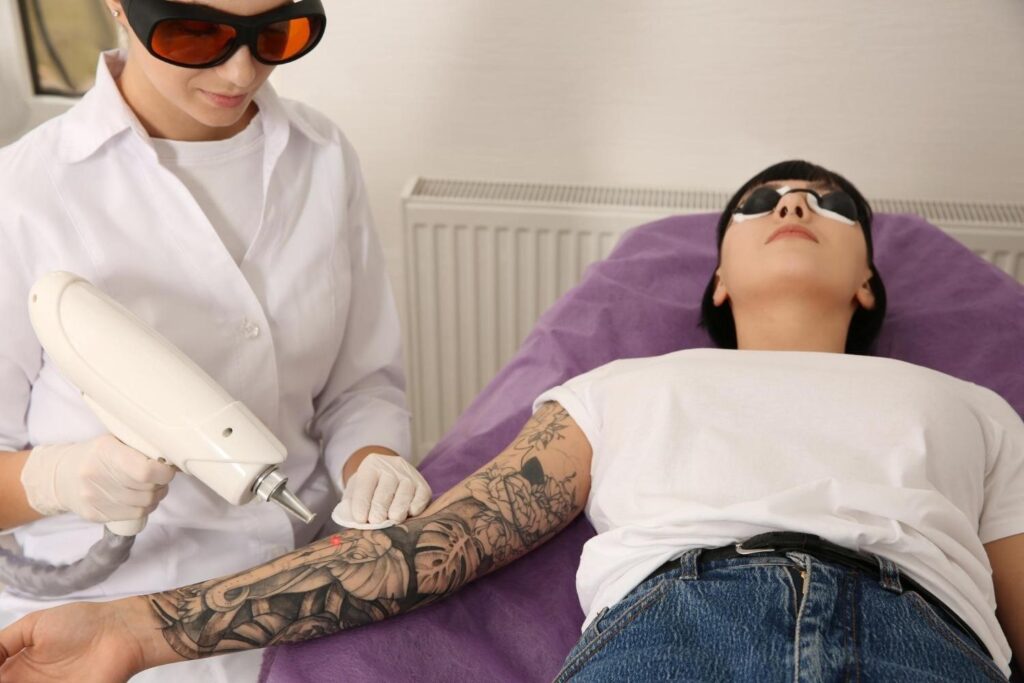 Comparing tattoo removal prices in Birmingham vs London with laser tattoo removal treatment and pricing consultation