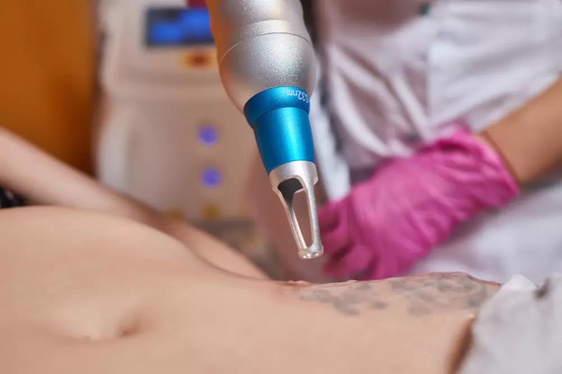 tattoo removal for different tattoo types