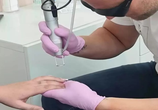 unwanted tattoo