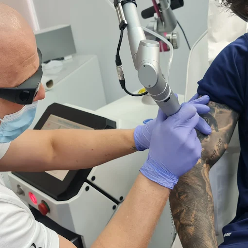 How to start a laser tattoo removal business in a professional clinic