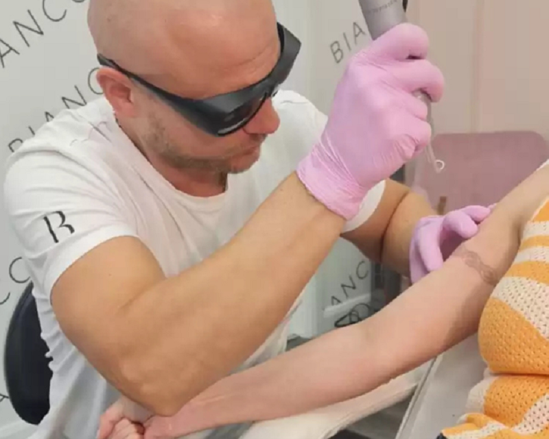 How many sessions of laser tattoo removal you need to fully remove a tattoo