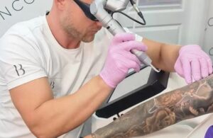 Alcohol after tattoo removal tattooed skin healing after a laser tattoo removal session