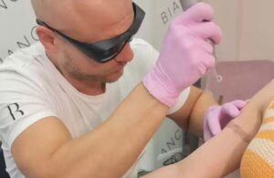 Can you get a Tattoo after tattoo removal treatment